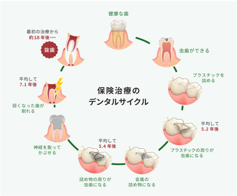 セラミックについて