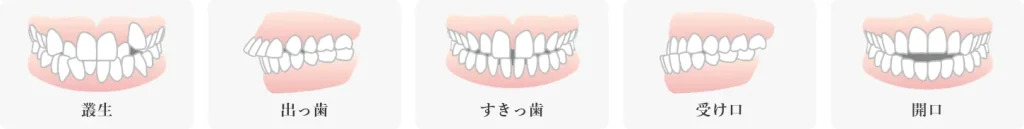 当院の矯正治療について